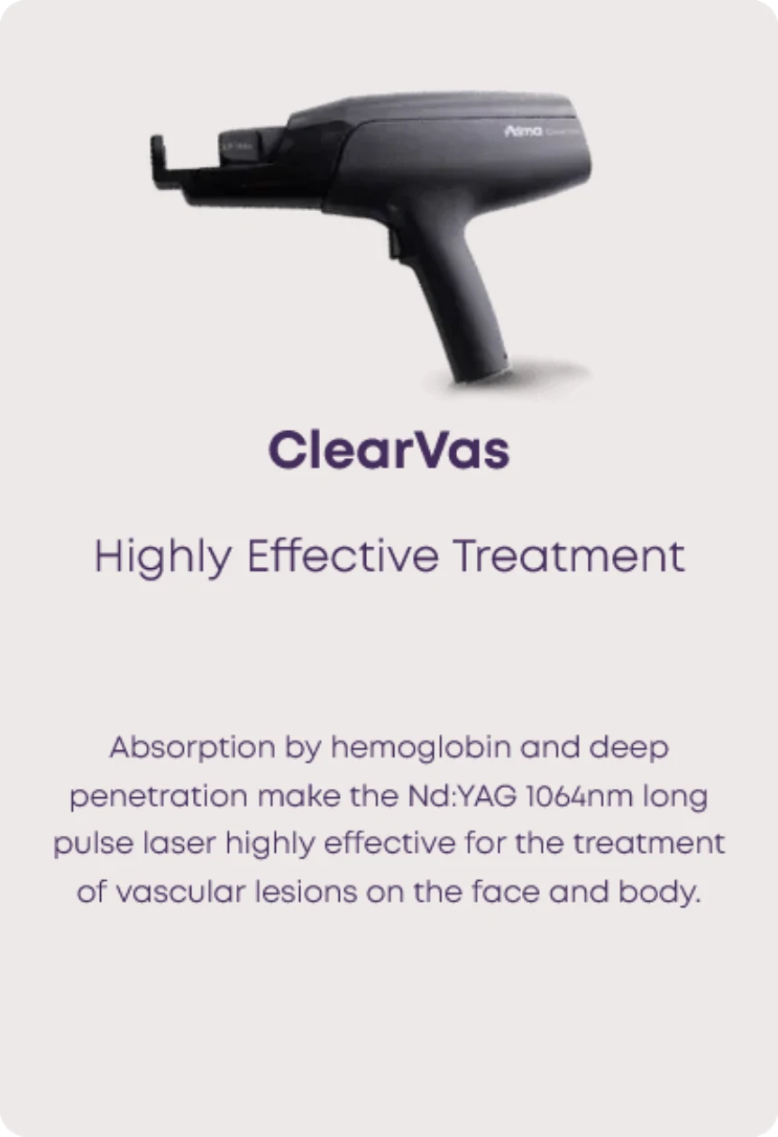 Alma Harmony - ClearVas